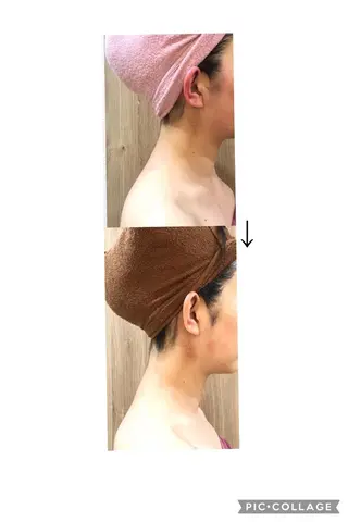 indiba soleilのエステ・リラクイメージ