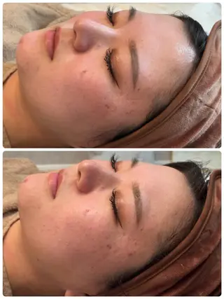 FLEURフェイシャ ル🫧ハーブ🌿小顔のエステ・リラクイメージ