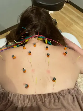 美容鍼灸サロン mahoroba院長のエステ・リラクイメージ