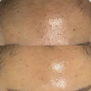 Whitening Beauty 行橋店所属・Whitening Beauty 行橋店のその他イメージ