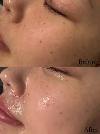 beautysalon LIMOA所属・松本 愛絵理のエステ・リラクイメージ