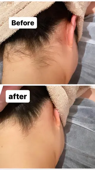 脱毛・エステサロン LuLuNのエステ・リラクイメージ