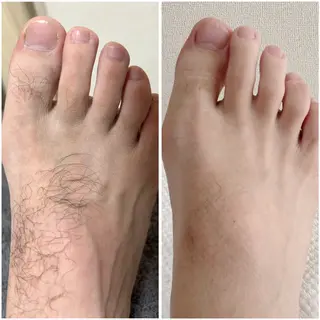 脱毛・ホワイトニング 耳ツボ・美白・毛穴のその他イメージ