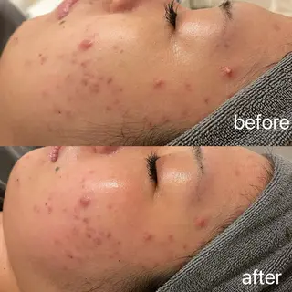 小顔＆まつ毛サロン AKANE❤️のエステ・リラクイメージ