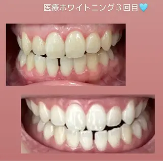 Kaula ホワイトニング🦷✨のエステ・リラクイメージ