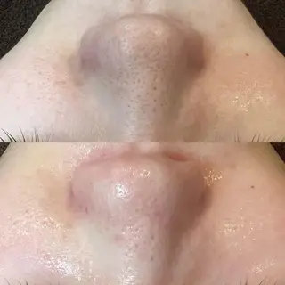 韓国系得意🦋 Aspire.のマツエク・マツパデザイン