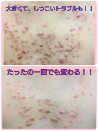 ハーブピーリング 専門店Kikkaのエステ・リラクイメージ