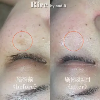 実方 梨々花のエステ・リラクイメージ