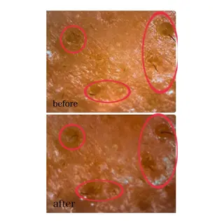 Lien~毛穴 専門サロンのその他イメージ