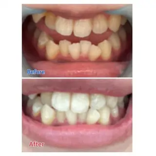 Ｍ渋谷 ホワイトニングのエステ・リラクイメージ