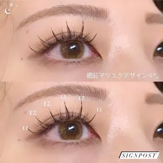 マツエク・マツパ Signpost🌼 アサイのマツエク・マツパデザイン