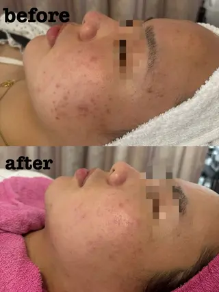 エレグラム所属・雑賀 由衣のエステ・リラクイメージ