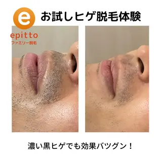 メンズ エピット横浜磯子店 大森のエステ・リラクイメージ