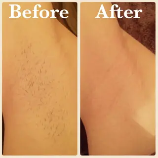 B.GLAM シュガーリング渋谷のエステ・リラクイメージ