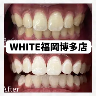 メンズ セルフホワイトニング WHITE福岡博多店のエステ・リラクイメージ