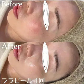 中目黒ハーブピーリン グ🌿ララピールのエステ・リラクイメージ