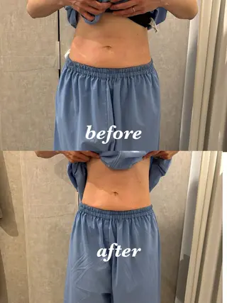 メンズ 腸活サポート みなみののエステ・リラクイメージ