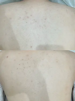 Tug エステサロン　高知駅前店所属・高知駅店Tug NONOKAのエステ・リラクイメージ