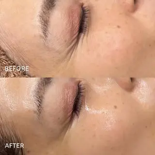 毛穴/肌管理/痩身/ ボディケア/satoのエステ・リラクイメージ