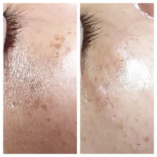 BASE Beauty Lounge所属・BASE🍯 KAORIのエステ・リラクイメージ