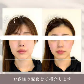 小顔矯正&美容整体 整え屋REDのエステ・リラクイメージ
