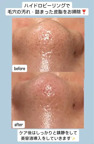 ベラージュ【美背中・ 美尻・フェイシャル】のエステ・リラクイメージ