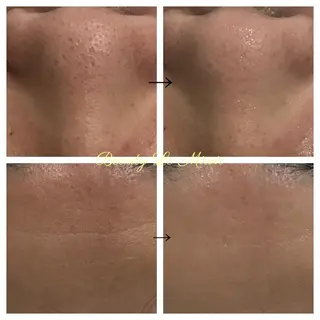 ビューティー ミロワールのエステ・リラクイメージ