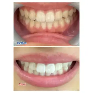 M渋谷 ホワイトニングのエステ・リラクイメージ