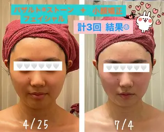 35歳からの エイジングケアサロンのエステ・リラクイメージ