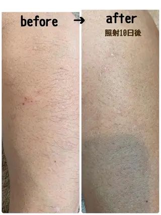 CHOUETTE所属・五島 久美子のエステ・リラクイメージ