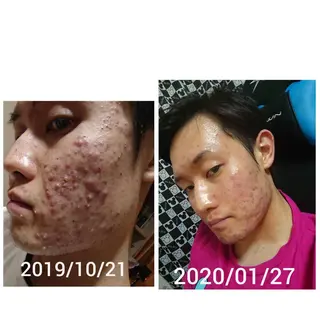 メンズ 朝重い人専用 肩甲骨調整のエステ・リラクイメージ