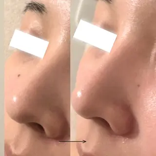 UEDA | POLA 天王寺のエステ・リラクイメージ