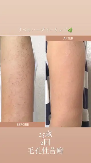 AtelierRin Ayumiのマツエク・マツパデザイン