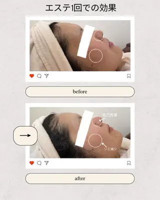 CSサロン Amule所属・Amule anna🦋のエステ・リラクイメージ