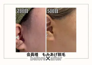 みんなの脱毛ツルリン ☀️船橋店☀️のエステ・リラクイメージ