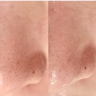 エステfreep takamoriのエステ・リラクイメージ