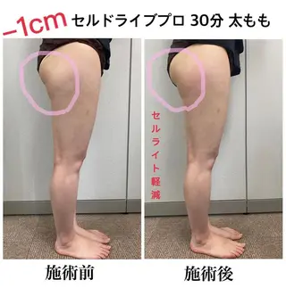 エステサロン Venusのその他イメージ