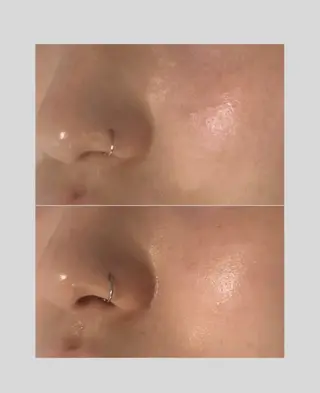 肌管理フェイシャル Utoutoのエステ・リラクイメージ