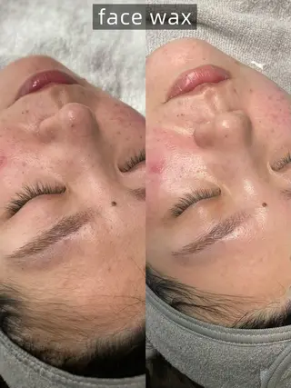 schön所属・schön 松井のエステ・リラクイメージ