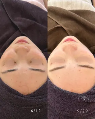 yukiko/美容師 ニキビ特化/肌質改善のエステ・リラクイメージ