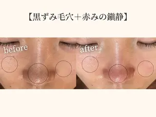 小顔矯正×毛穴サロン DRRAMSPA町田のエステ・リラクイメージ