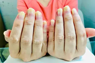 ネイル ホワイトニング🦷 ネイル💅LEAのその他イメージ