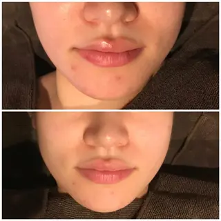 プルケル スパのエステ・リラクイメージ