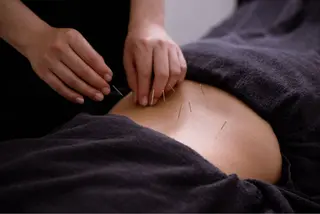 小顔矯正・美容鍼 FLOW鍼灸整体院のエステ・リラクイメージ