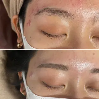 アイブロウ メンズ Epina 千葉店 【エピナ】のエステ・リラクイメージ