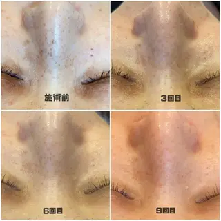 D’accord Rikoのネイルデザイン