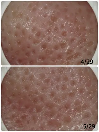 メナード片町 やまもと みくのエステ・リラクイメージ