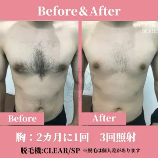 メンズ キッズ 有人型セルフサロン 脱毛/痩身/美顔のエステ・リラクイメージ