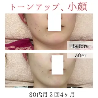 小顔・ニキビ ・脱毛サロンのエステ・リラクイメージ