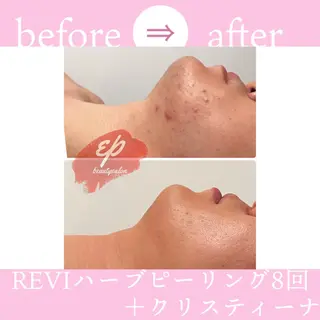 beauty salon epのエステ・リラクイメージ